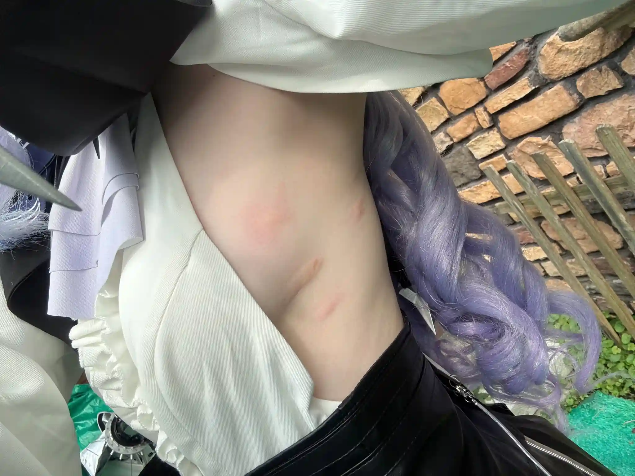 Vivian Cosplayer Gets Mosquito Bitten on Her Boobs